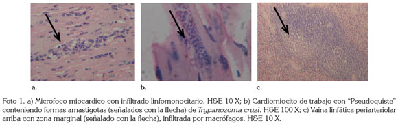 Vista De Aproximacion Diagnostica Histopatologica A La Cardiomiopatia Chagasica Cronica En Saguinus Leucopus Dentro De Programas De Rehabilitacion Y Reintroduccion Revista U D C A Actualidad Divulgacion Cientifica